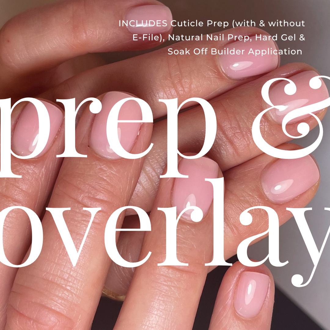 Prep & Overlay Masterclass - ONLINE